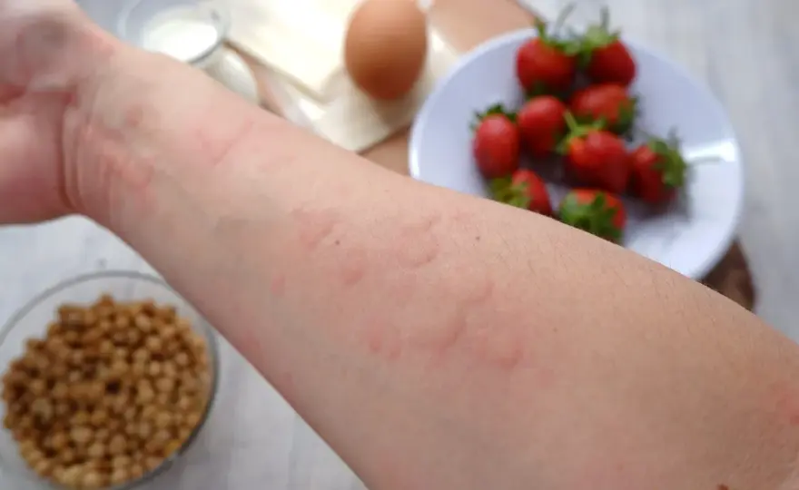 Alergia u dziecka: Szybka ulga w domu i kiedy do lekarza?